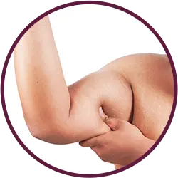 Arms